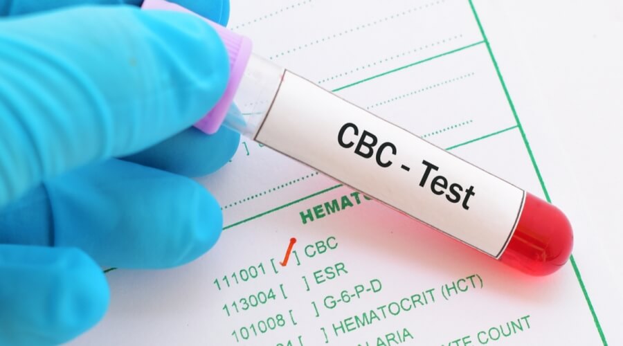 تحليل CBC